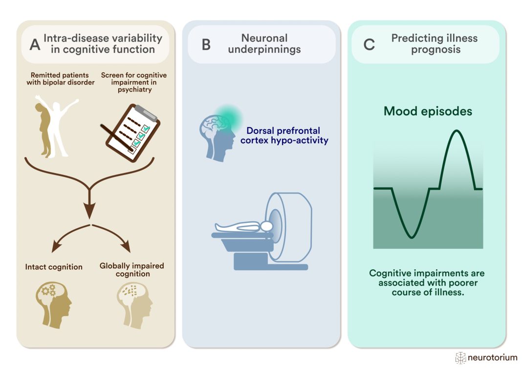 Using Liraglutide May Slow Alzheimer's Progression, Study Finds